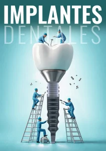 En Odontología Integral somos expertos en implantes dentales